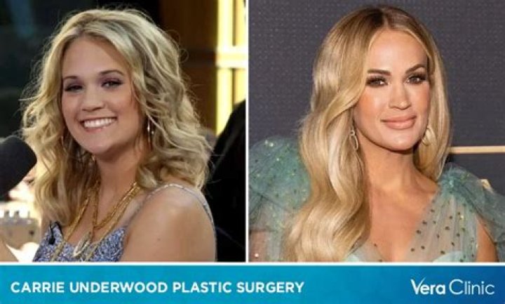 Carrie Underwoods Lip Scar Is Visible In Latest Close-Up Selfie Hollywood Life |