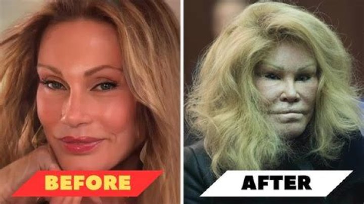 Dr. Now Concerned After Biancas Failed Surgery Hollywood Life