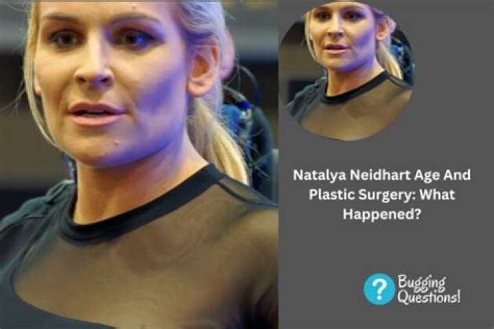 Has Natalya Neidhart Had Plastic Surgery: Who Is Natalya Neidhart?