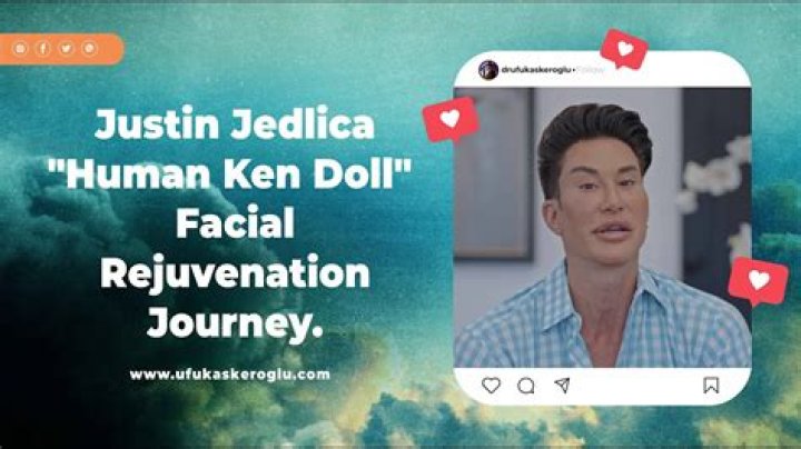 Human Ken Doll Justin Jedlica Gives Plastic Surgery Update Hollywood Life