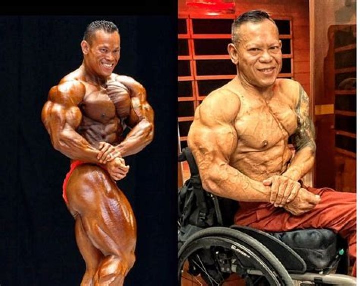 Kris Dim Accident And Spinal Injury What Happened To Him? Age And Wiki